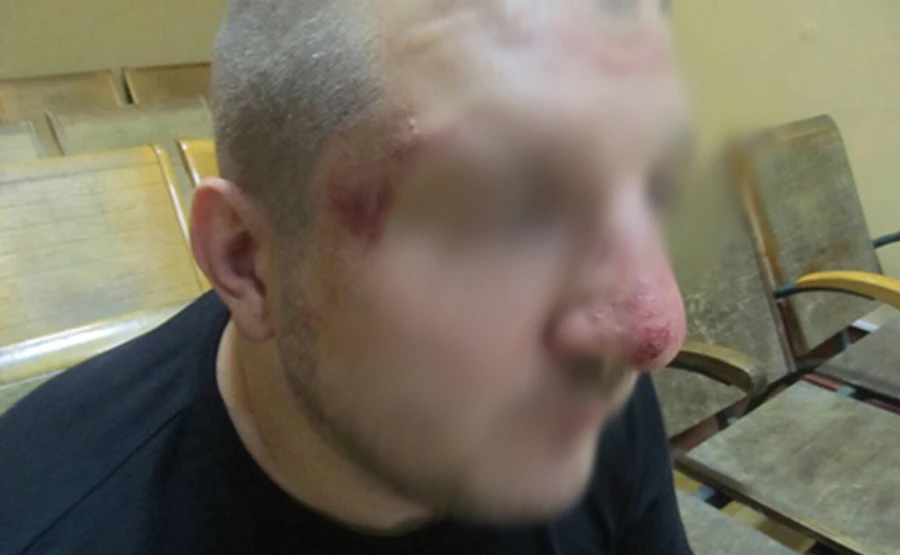 Российские пограничники избили украинца - Госпогранслужба