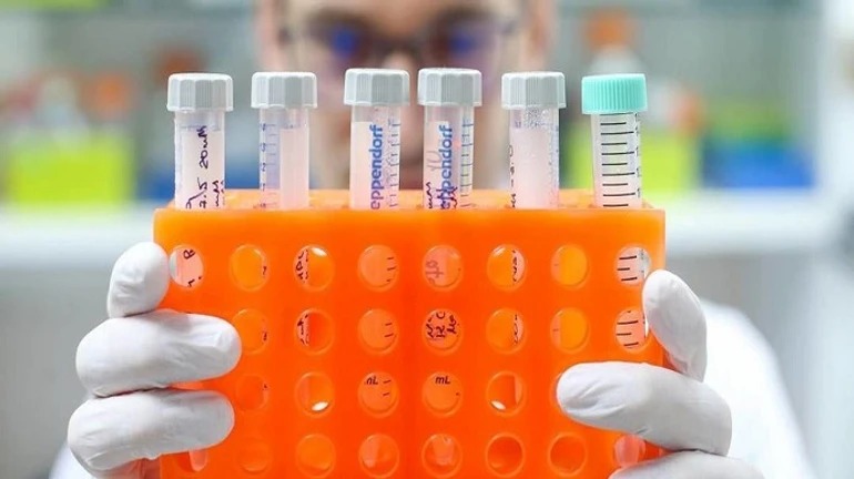 В мире пандемия COVID идет на спад, а в России – усиливается