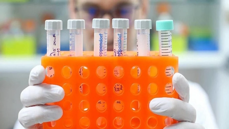 У світі пандемія COVID іде на спад, а в Росії – посилюється