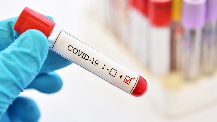 За добовою смертністю від COVID-19 Україна залишається другою в Європі