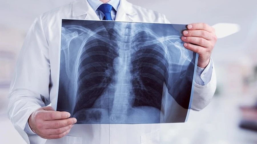 Почти 2000 человек продолжают лечение от COVID-19 на Ровенщине