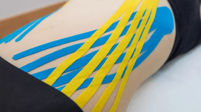 Реабілітація, набряки чи спортивні травми: як працюють тейпи та що про них каже наука