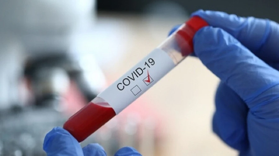 З березня від COVID-19 у світі померли 366 журналістів