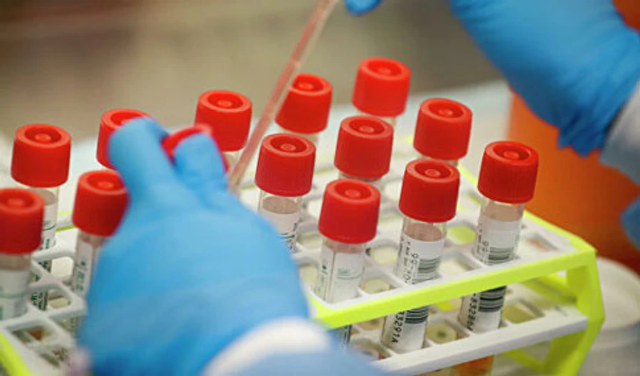 В Україні 6 нових випадків COVID-19, а в Кропивницькому закривають маршрути: хворий водій 