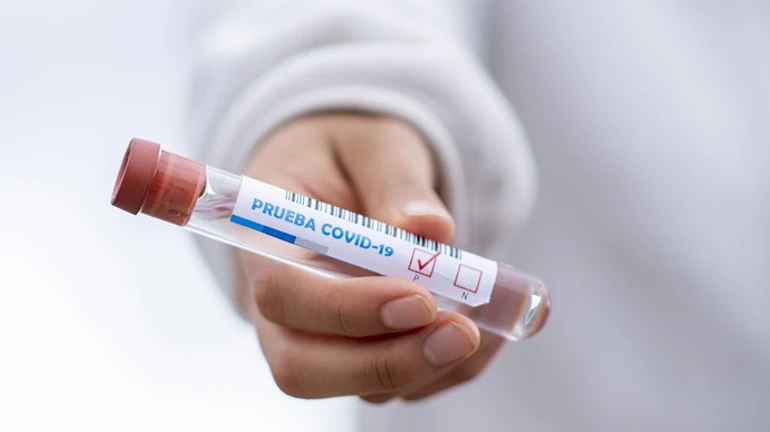 Темпы роста заболеваемости коронавирусом замедлились – КШЭ