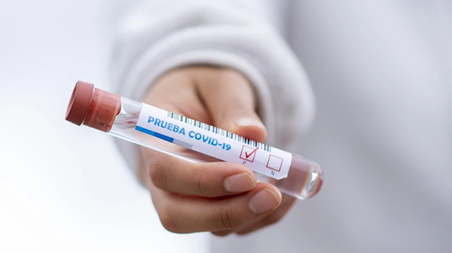 Темпы роста заболеваемости коронавирусом замедлились – КШЭ