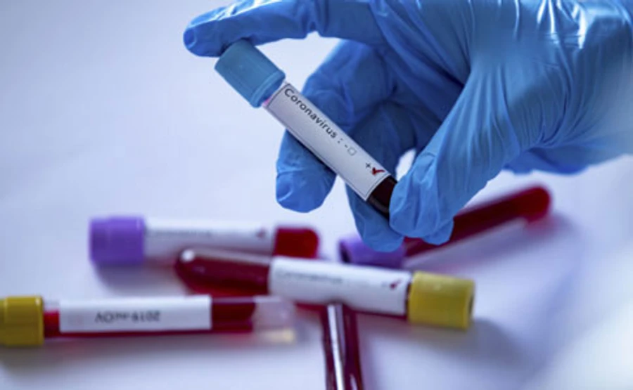 На Запорожжі вже 5 хворих на коронавірус 