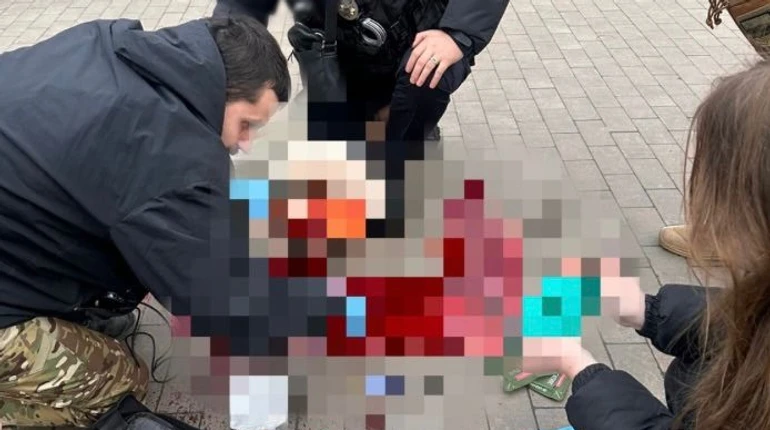 В Киеве в больнице умерла женщина, которую ранили обломки российского дрона