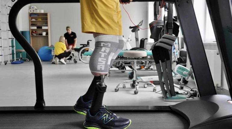 Дружина сказала: Відрощуй ноги. Як почувається перший в Україні пацієнт з протезами, вживленими в кістку