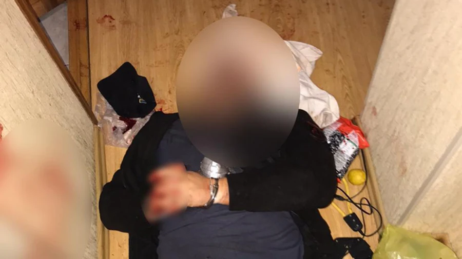 Оборотни в полицейской форме подстрелили кандидата в депутаты в Сумской области