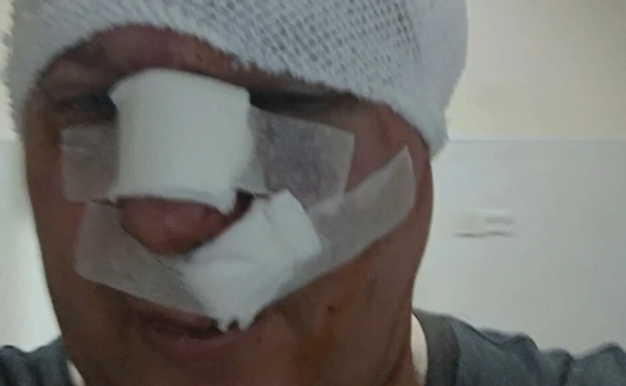 Скандального догхантера Святогора избили