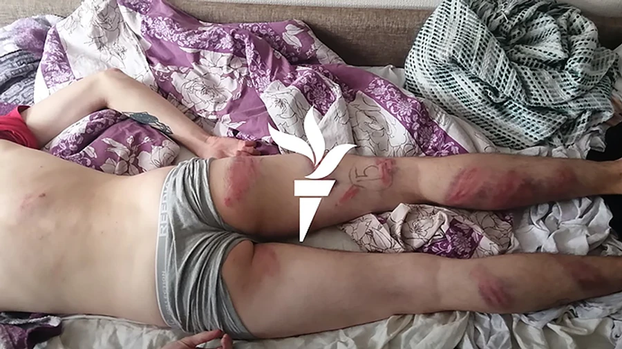 Спрашивали, кто лучший президент мира: Задержанный в Минске рассказал о пытках