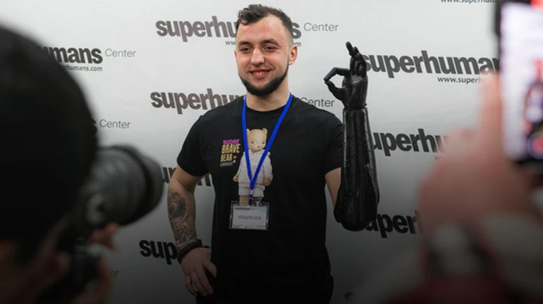 Happiness is to have a hand again. Soldier talks about injuries, amputation and electric prosthesis