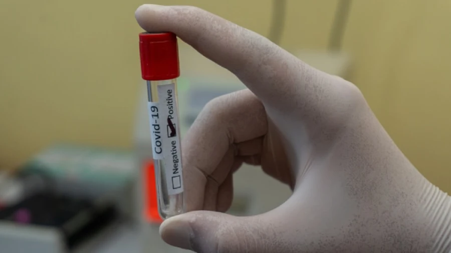 У британській лабораторії зупинили тести на COVID-19 через 43 тисячі помилкових результатів