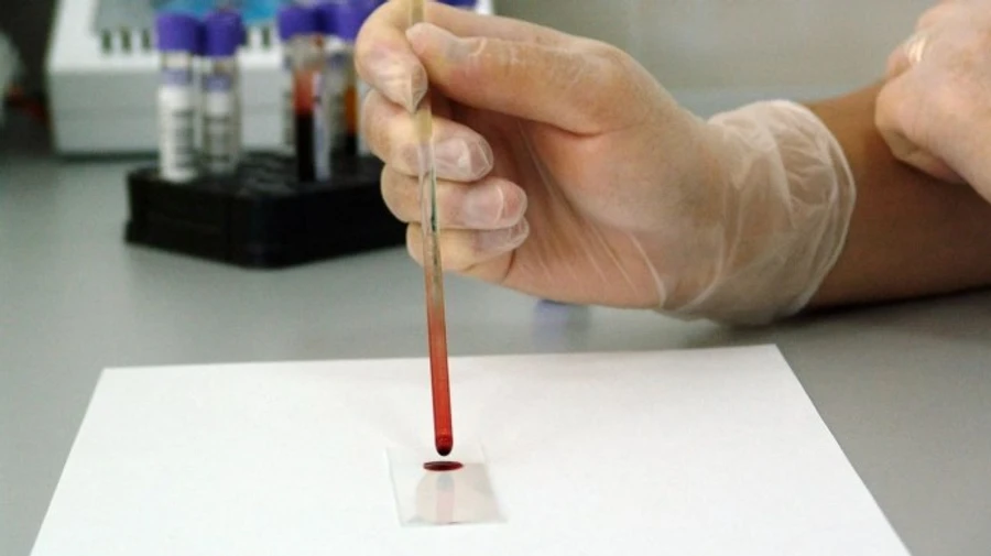 Ученые исследуют новый штамм коронавируса