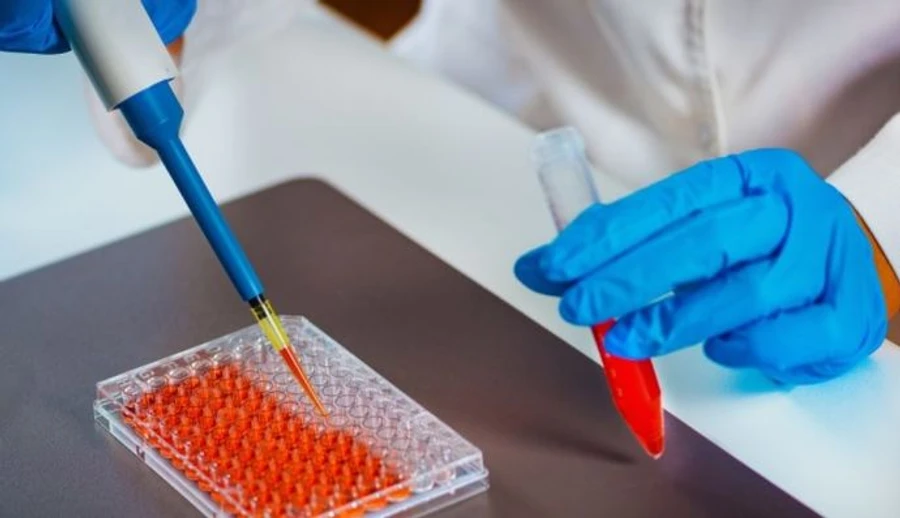 Кафе, рестораны и торговые центры в Киеве обязали проводить ИФА-тесты работникам