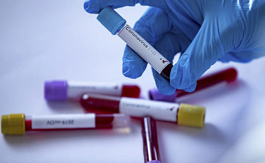 Після хвороби Шахова всім в Офісі Зеленського зробили тест на COVID-19