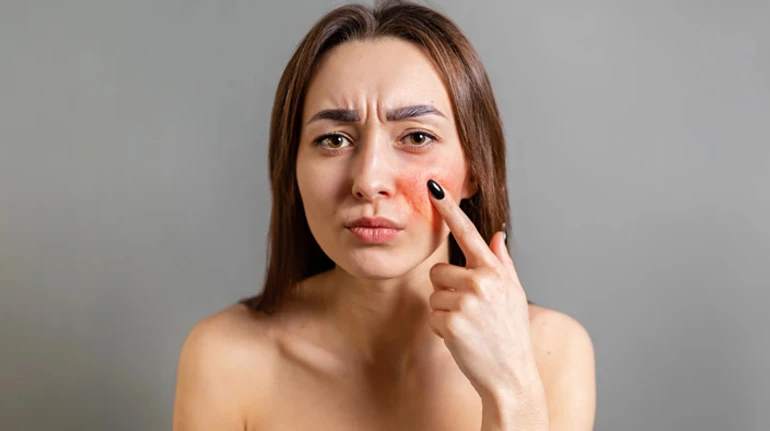 Що обличчя може розповісти про наше здоров'я