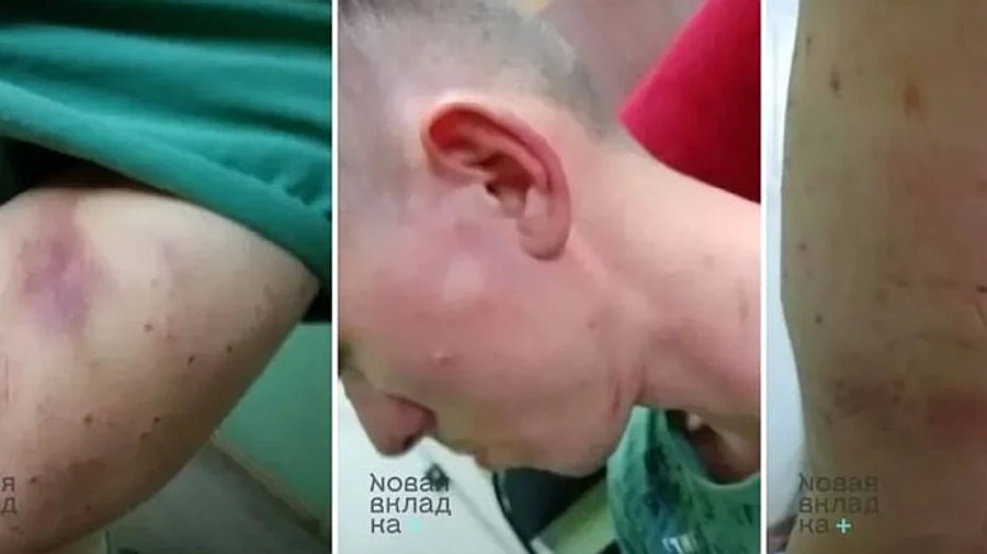 Giant letter Z set on fire in Belgorod: detainee claims he was tortured