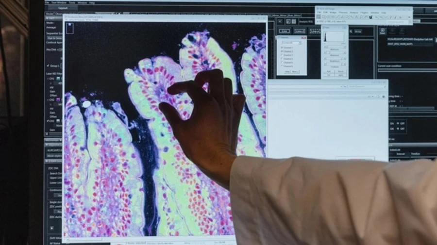 Russian scientist at Harvard faces trial and deportation for alleged smuggling of frog embryos – NYT