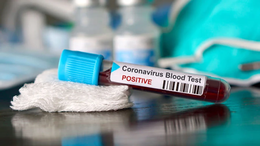 В Індонезії найвищий показник смертності від COVID за добу