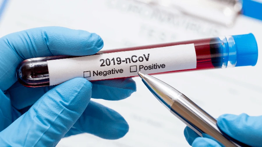 Пожилым людям почти вдвое проще вновь заразиться COVID-19, нежели молодежи - Lancet