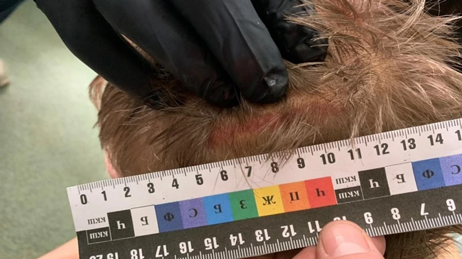 Били железным стулом: двух полицейских из Черкасской области подозревают в пытках