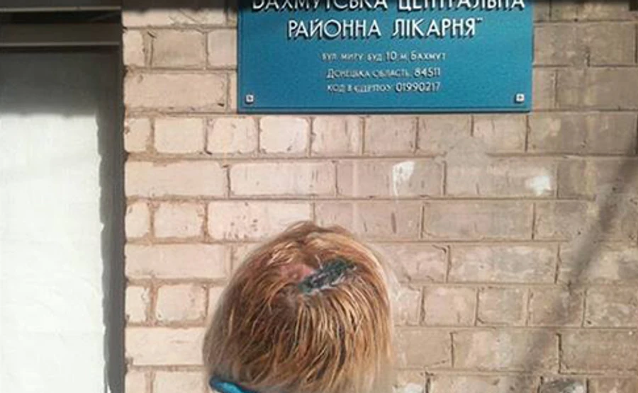 СЦКК: під час обстрілу Майорська поранено місцеву жительку