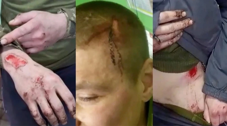 Сухопутные войска дистанцировались от скандала в Скале и ждут правовой оценки