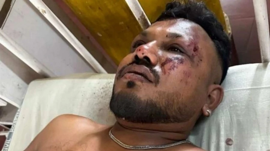 В авіакатастрофі в Індії є вцілілий пасажир, який встав і побіг