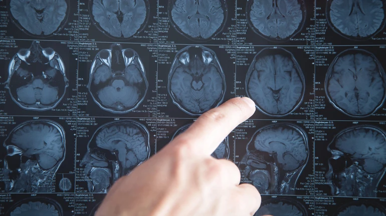 Может проникать внутрь? Ученые назвали 5 способов, как микропластик может навредить мозгу