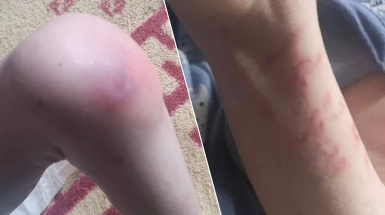 Недоїдання, антисанітарія та проблеми з розвитком: у Білій Церкві з родини вилучили трьох дітей