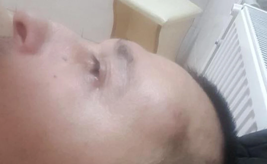 В Черновцах теперь избили председателя организации Стоп коррупции