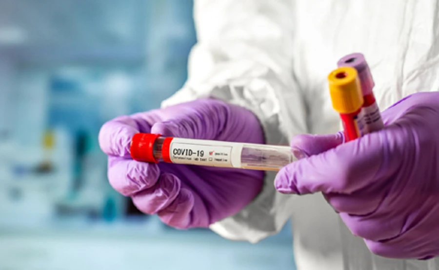 У МОЗ пояснили, кому зобов'язані проводити тест на COVID-19