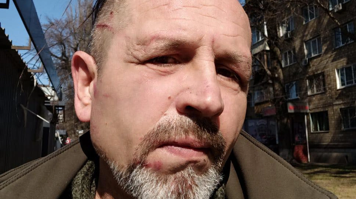 Київська поліція перевіряє інформацію про побиття ветерана Балуха в приміщенні ТЦК