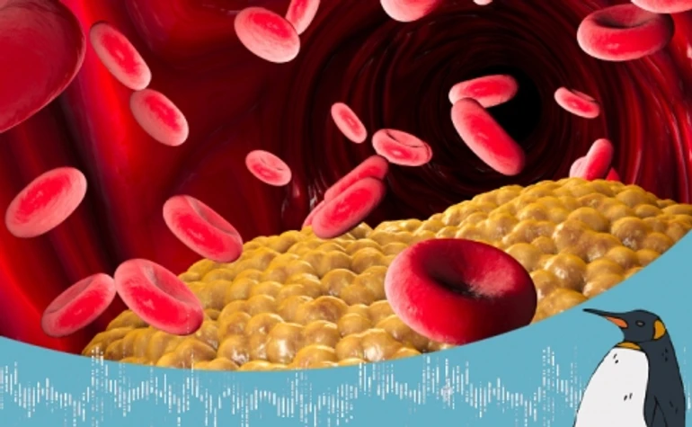 Плохой и хороший парни. Или, что нужно знать о холестерине. Беседа с кардиологом