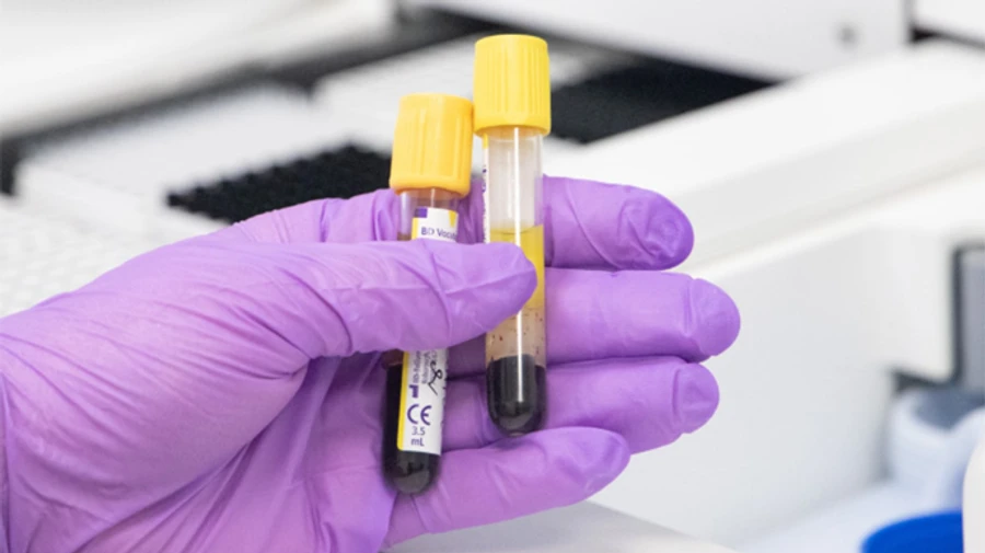 В Киеве в воскресенье немного снизилось количество новых больных и смертей от Covid-19