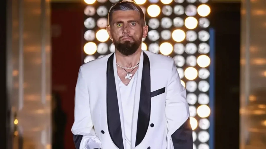 Amputee war veterans take to the catwalk at Ukrainian Fashion Week, modelling adaptive clothing – video