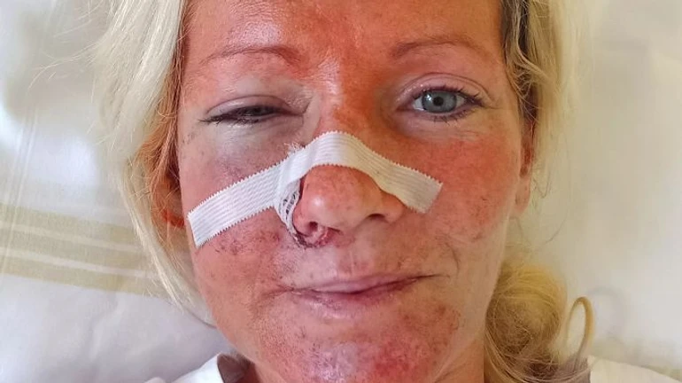 In Czechia, man brutally attacked two Ukrainian women after learning about their nationality