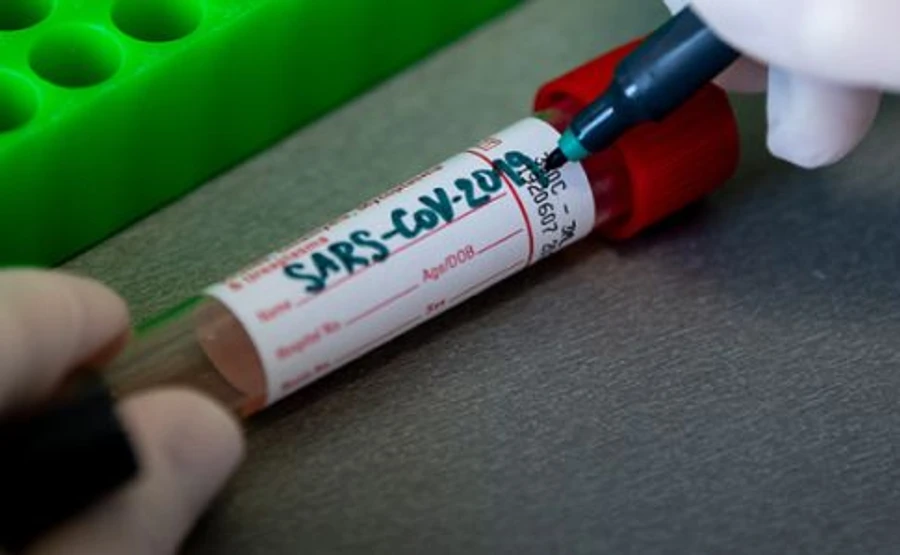 Более 10 миллионов граждан в США прошли тест на COVID-19