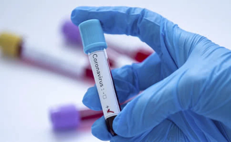 COVID-19: В Італії кількість хворих зросла до 41 035 осіб