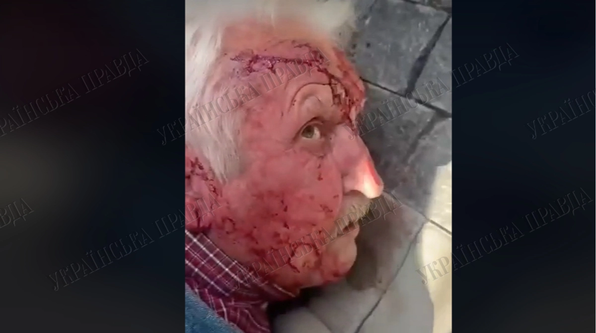 УП: У нападника на командира "Хартії" не спрацювала зброя
