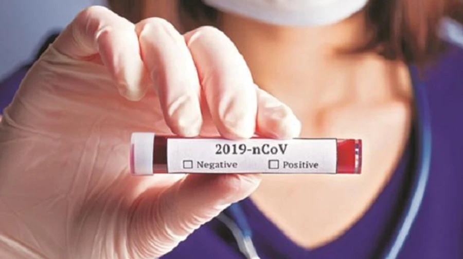 У США за добу – понад 2 тисячі смертей від коронавірусу