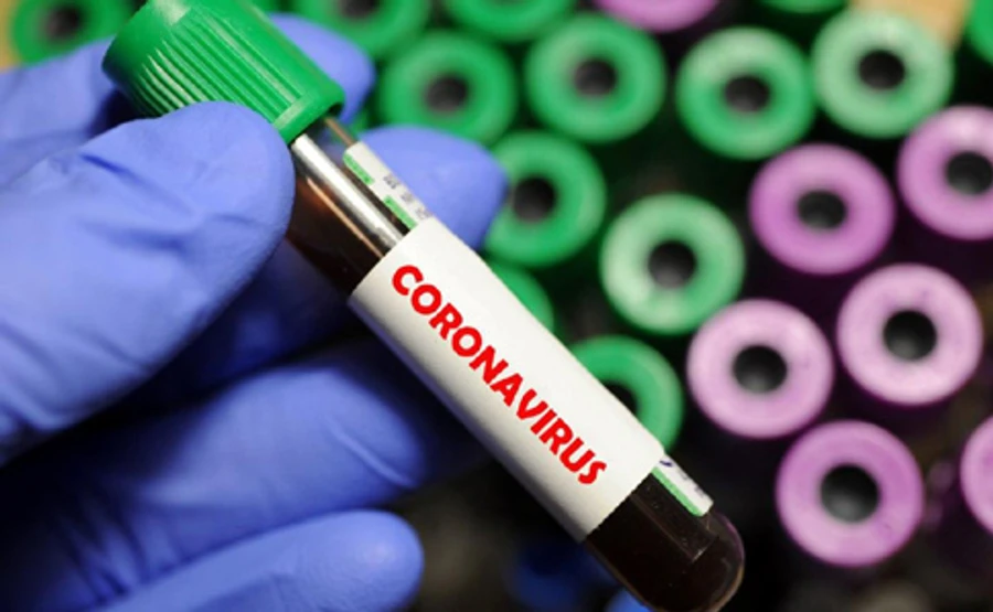 На Рівненщині заявили про смерть жінки, в якої виявили COVID-19