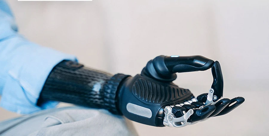 List of prostheses manufacturers compiled in Ukraine: Why it is useful