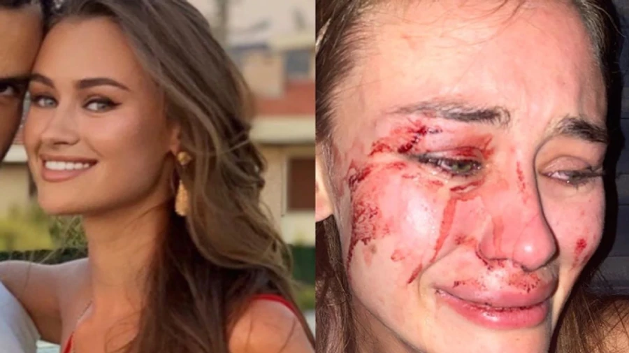 У Туреччині побили українку: МВС звернулося до посольства