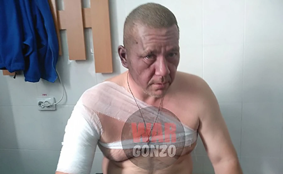 Від вибуху в Донецьку постраждав кандидат на посаду глави ДНР