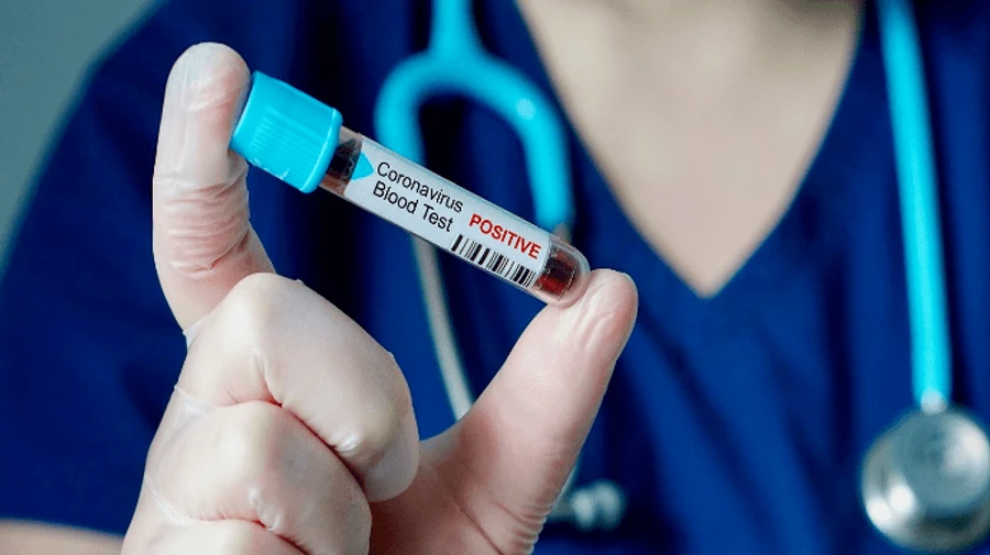 В мире зарегистрировали самое малое за месяц количество больных COVID-19