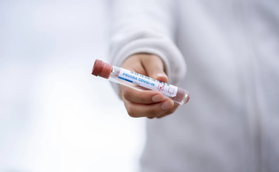 Правительство доложило Зеленскому, когда будет пик эпидемии коронавируса в Украине