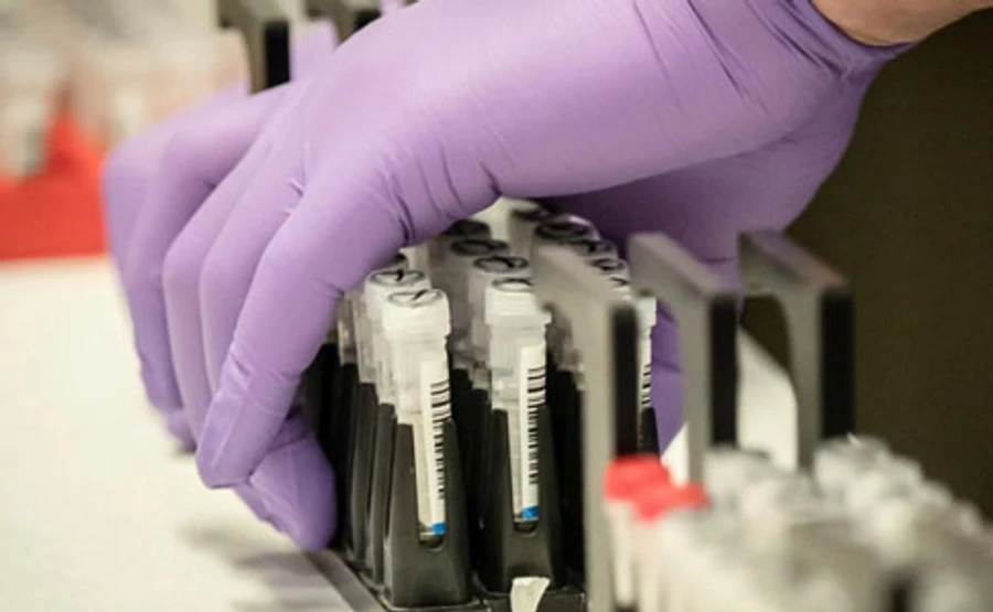 На Дніпропетровщині зафіксували ще 2 випадки COVID-19